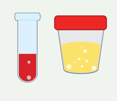 Creatinine Clearance (24 Hour) Urine and Blood Test Online 